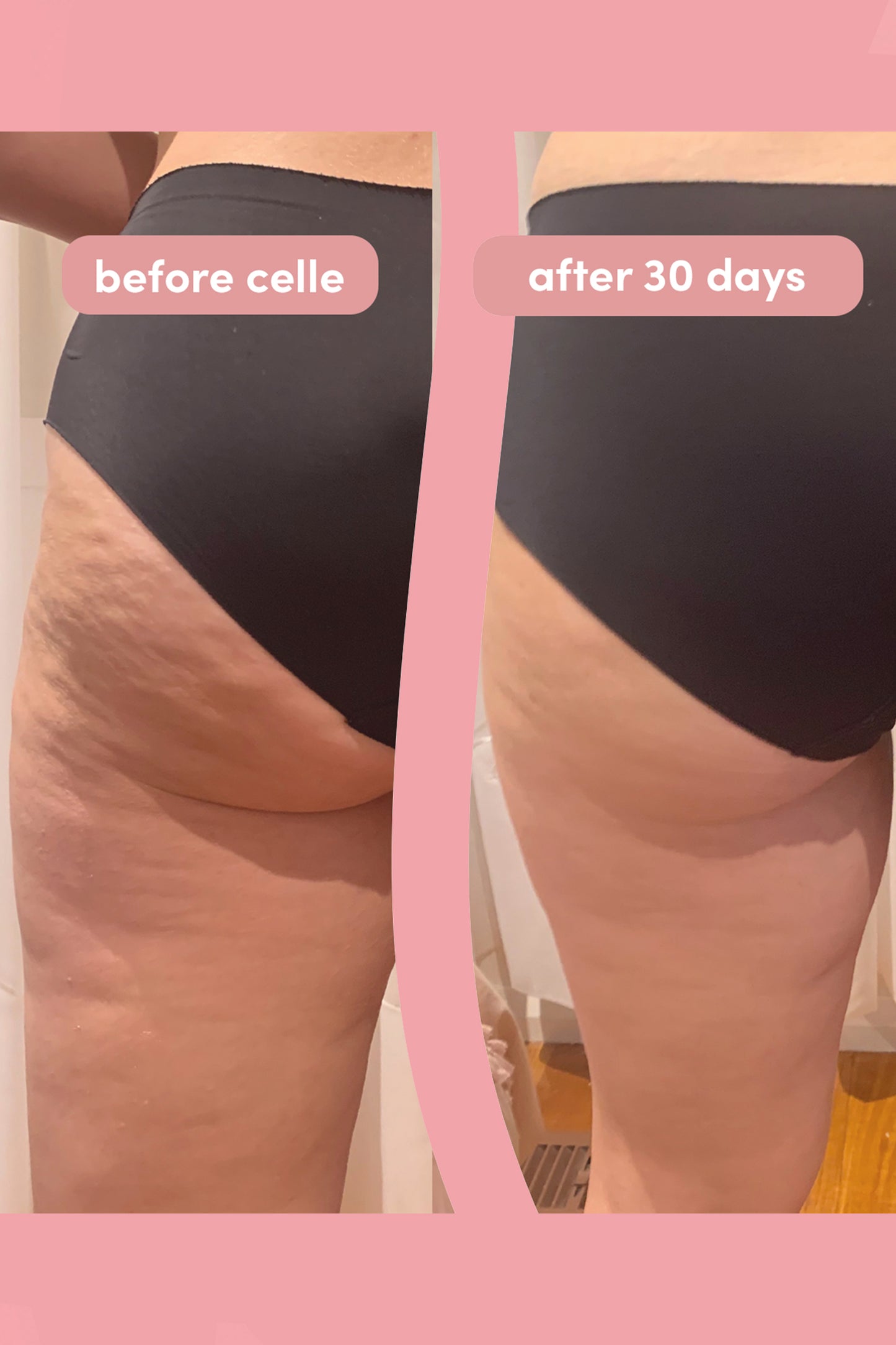 Celle Skin Before After Results